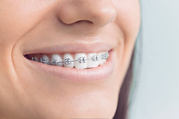 Best Invisalign and Clear Aligners  in West Pensacola, FL